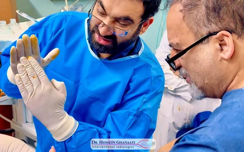 سوزاندن تومور با لیزر 3 سوزاندن تومور با لیزر