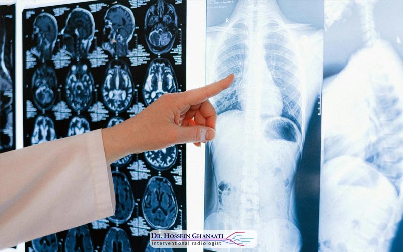 رادیولوژی اینترونشنال چیست؟