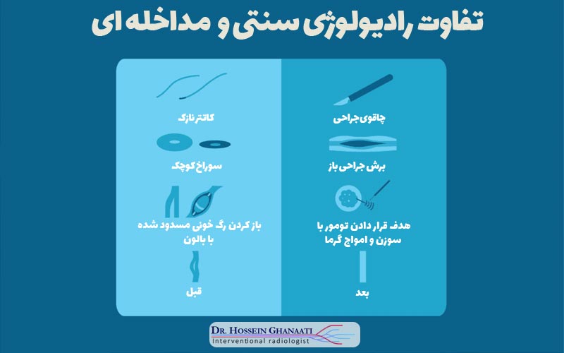 اینترونشنال یعنی چی 3 فرق اینترونشنال و جراحی باز