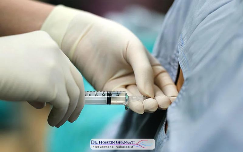 تزریق اپیدورال چیست و چگونه عمل می‌کند؟