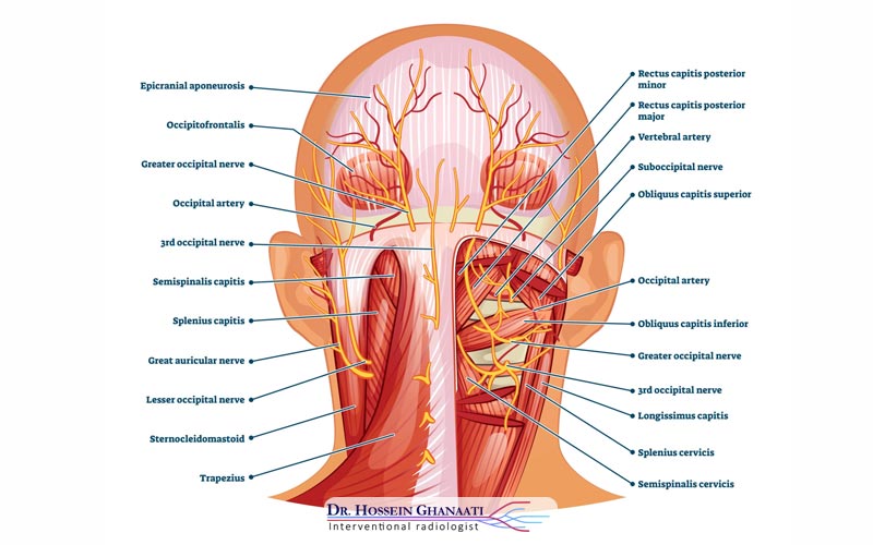آناتومی اعصاب اکسیپیتال و پاتوفیزیولوژی درد