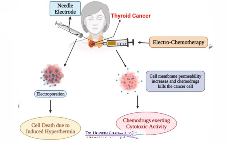 الکتروشیمی درمانی 5 تکنولوژی الکتروشیمی درمانی