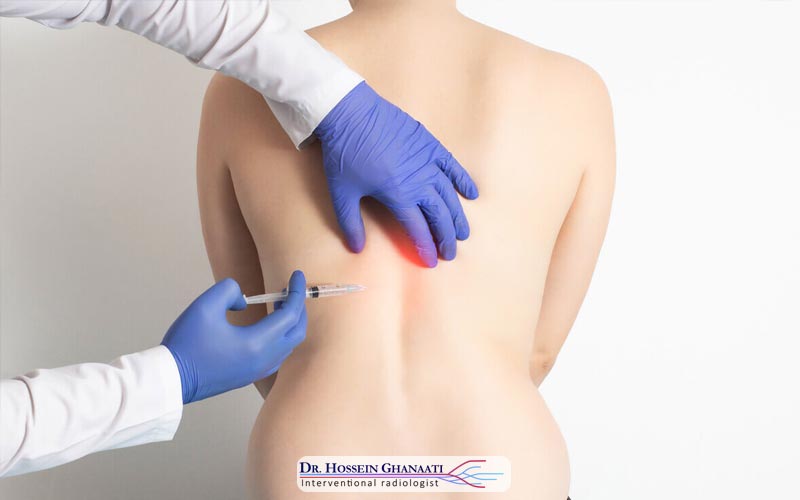 هزینه اوزون تراپی دیسک کمر