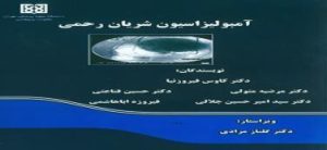 آمبولیزاسیون شریان رحمی