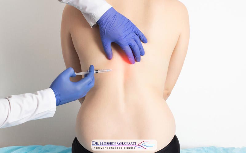 اوزون تراپی دیسک کمر