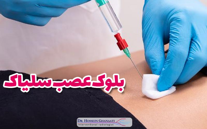 بلوک عصب سلیاک 7 بلوک عصب سلیاک