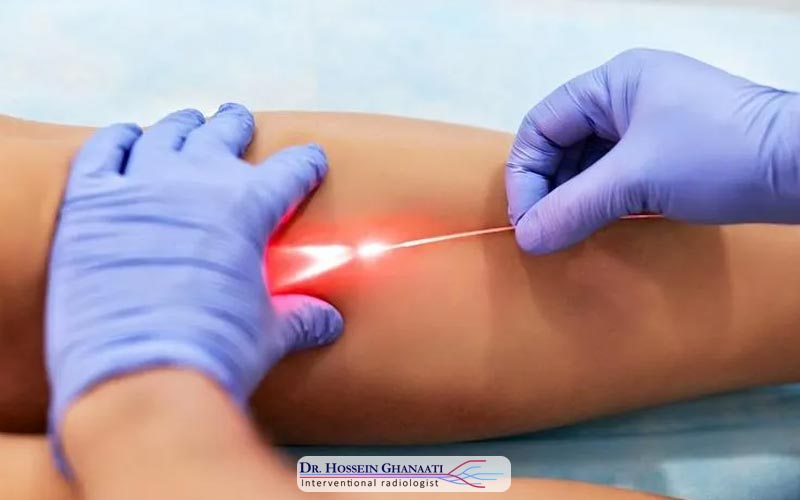 روش‌های تشخیص واریس اندام تحتانی