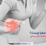 مداخلات صفراوی