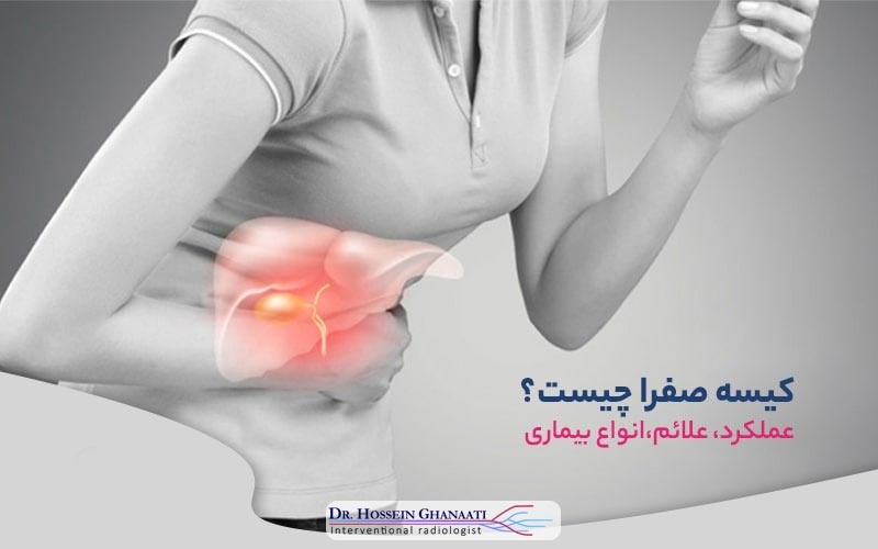 مداخلات صفراوی