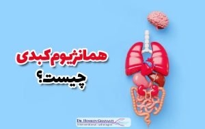همانژیوم کبدی