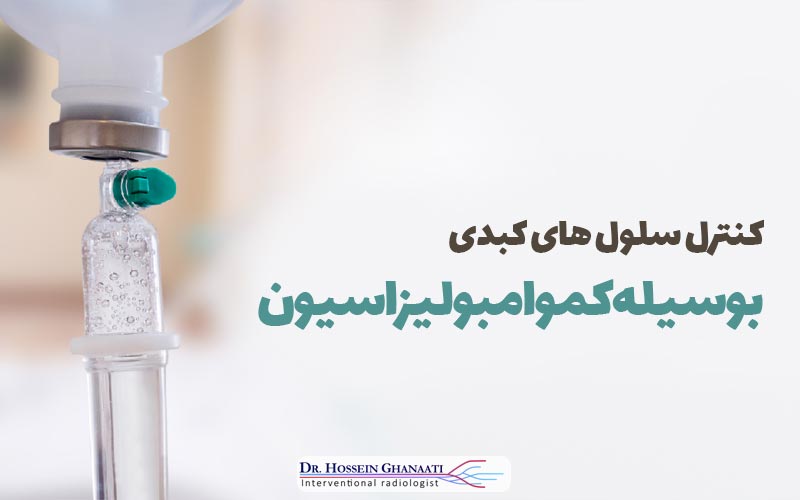 کموامبولیزاسیون 6 کموامبولیزاسیون چیست