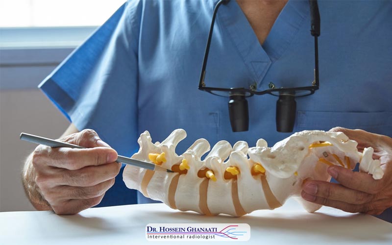 تزریق سیمان به ستون فقرات